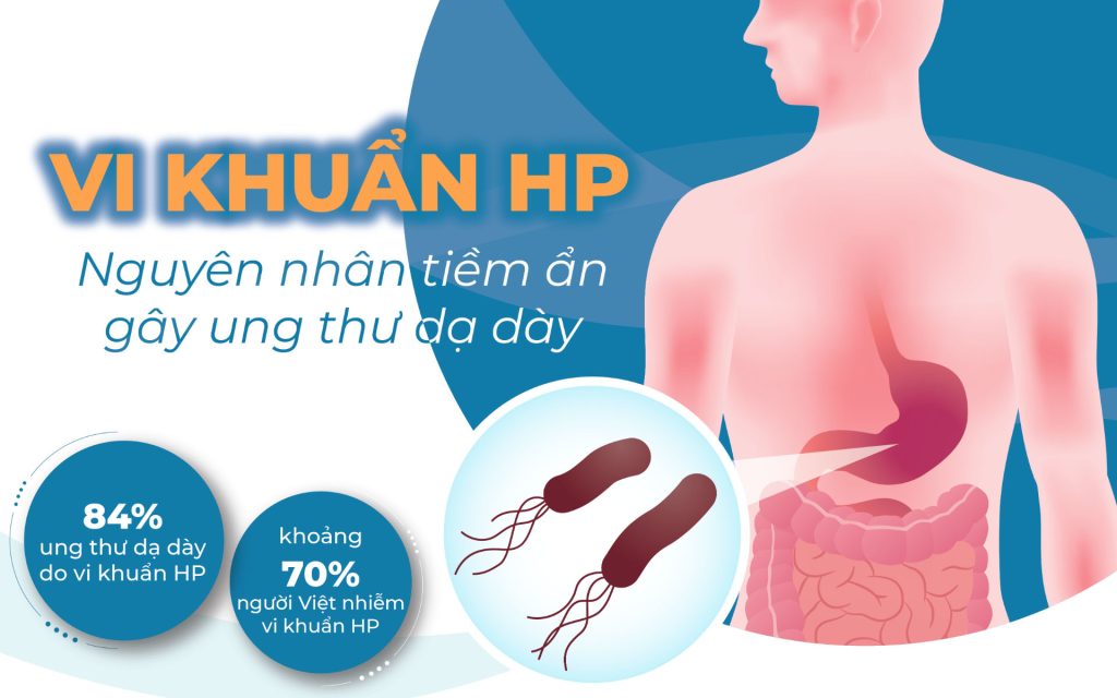 Vi khuẩn HP và Ung thư dạ dày: Mối nguy hiểm thầm lặng cần cảnh giá 1 vi khuan hp